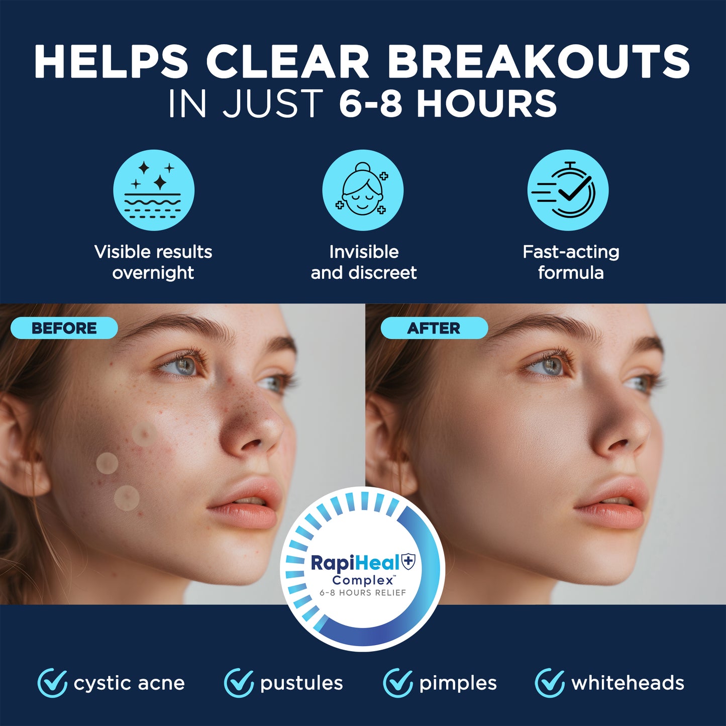 Pimple Patches 3 Sizes (S, M, L)