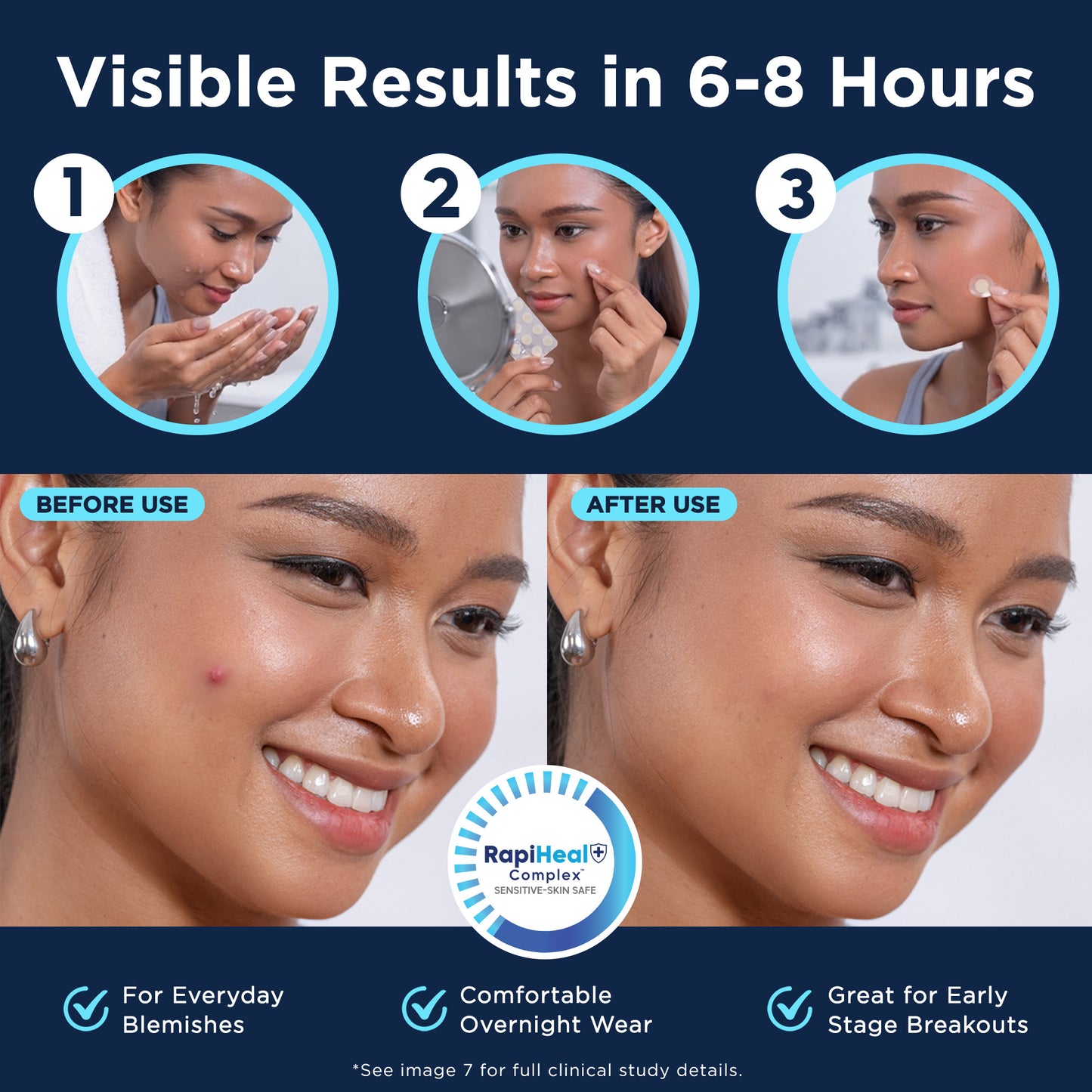Pimple Patches 3 Sizes (S, M, L)